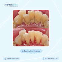 Dental Police | Dental Clinic Sumatera Utara