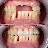 Van Dental Solution VDS- Dokter Gigi Medan (drg. Vandersun Lestari, Sp.Perio & drg. Sherly Tjandra)