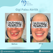 Van Dental Solution VDS- Dokter Gigi Medan (drg. Vandersun Lestari, Sp.Perio & drg. Sherly Tjandra)