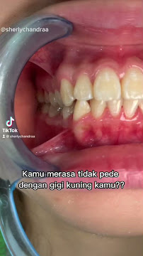 Van Dental Solution VDS- Dokter Gigi Medan (drg. Vandersun Lestari, Sp.Perio & drg. Sherly Tjandra)