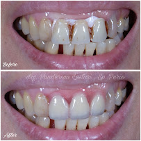 Van Dental Solution VDS- Dokter Gigi Medan (drg. Vandersun Lestari, Sp.Perio & drg. Sherly Tjandra)