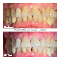 Van Dental Solution VDS- Dokter Gigi Medan (drg. Vandersun Lestari, Sp.Perio & drg. Sherly Tjandra)