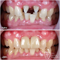 Van Dental Solution VDS- Dokter Gigi Medan (drg. Vandersun Lestari, Sp.Perio & drg. Sherly Tjandra)