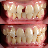 Van Dental Solution VDS- Dokter Gigi Medan (drg. Vandersun Lestari, Sp.Perio & drg. Sherly Tjandra)