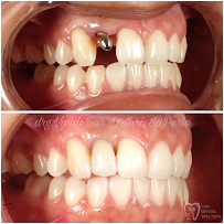 Van Dental Solution VDS- Dokter Gigi Medan (drg. Vandersun Lestari, Sp.Perio & drg. Sherly Tjandra)