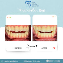 Van Dental Solution VDS- Dokter Gigi Medan (drg. Vandersun Lestari, Sp.Perio & drg. Sherly Tjandra)