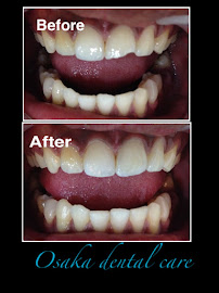 Osaka dental care / klinik gigi Osaka / Klinik Gigi Terbaik