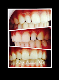 Osaka dental care / klinik gigi Osaka / Klinik Gigi Terbaik