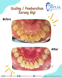 Dokter Gigi Medan - Royal Dental Center Asia