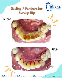 Dokter Gigi Medan - Royal Dental Center Asia