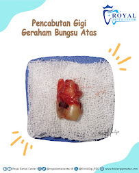 Dokter Gigi Medan - Royal Dental Center Asia
