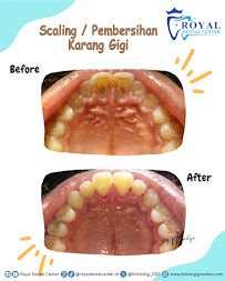 Dokter Gigi Medan - Royal Dental Center Asia