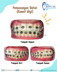 Dokter Gigi Medan - Royal Dental Center Asia