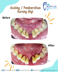 Dokter Gigi Medan - Royal Dental Center Asia