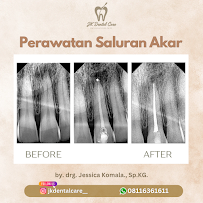 JK DENTAL CARE by drg. Jessica Komala., Sp. KG / Praktek Dokter Gigi Jessica Komala Spesialis Konservasi Gigi
