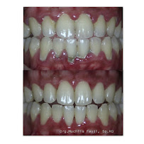 Smile Station | Dental Specialist
