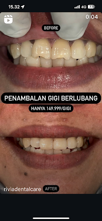 RIVIA DENTAL CARE PRAKTEK DOKTER GIGI