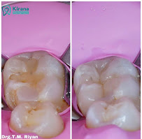 Kirana Dental Clinic