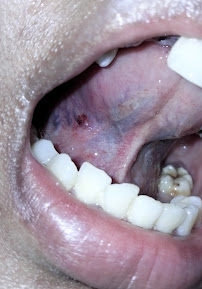 Ria Dental Care (Batu Aji)