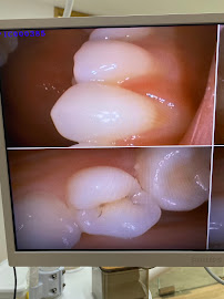 KINI Dental Clinic Batam