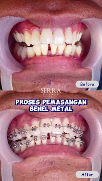 Serra Dental Batam I Klinik Gigi Batam