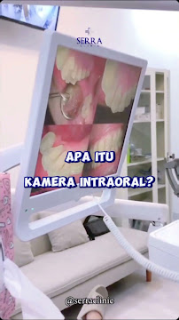 Serra Dental Batam I Klinik Gigi Batam