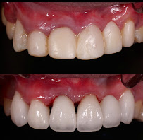 Dental Box Batam
