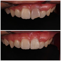 Dental Box Batam