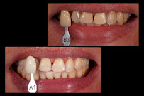 Dental Box Batam
