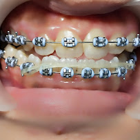 Khalila Batam Dental Care