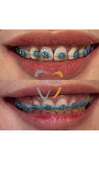 Lidya Dental Care Batam Centre