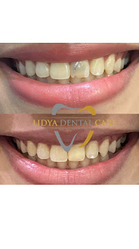 Lidya Dental Care Batam Centre