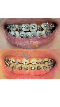 Lidya Dental Care Batam Centre