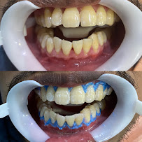 Lidya Dental Care Batam Centre