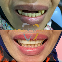 Lidya Dental Care Batam Centre