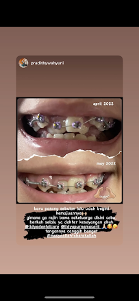 Lidya Dental Care Batam Centre
