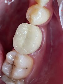 Batam Dental Center Tiban