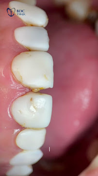 Batam Dental Center Tiban