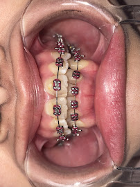 Batam Dental Center Tiban