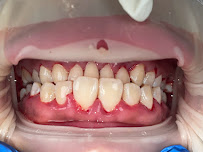 Batam Dental Center Tiban