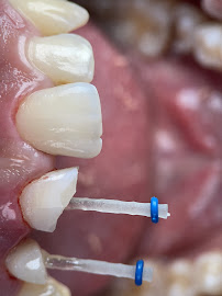 Batam Dental Center Tiban