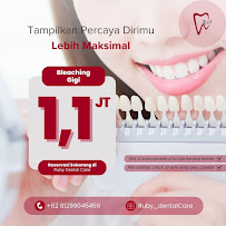 Ruby Dental Care Batu Aji