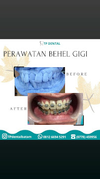 Dokter gigi batam (TP dental)
