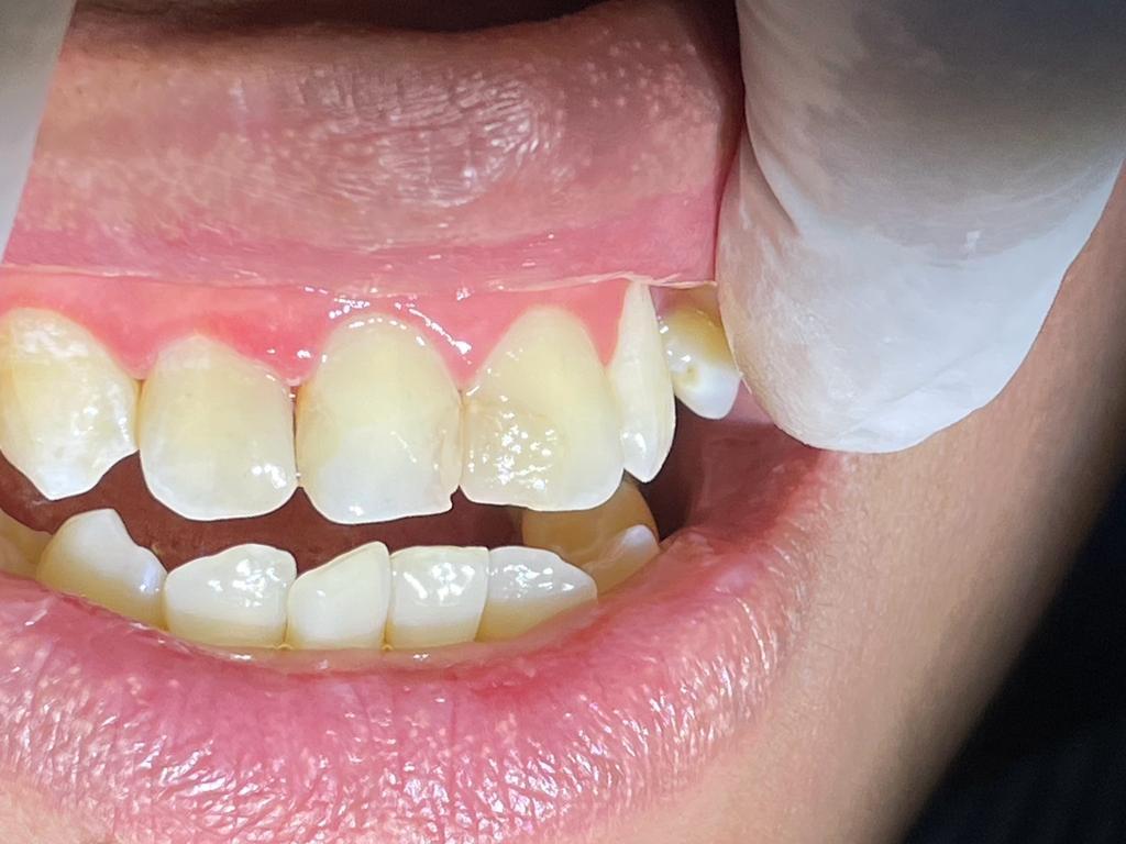 Family Dental Care - dental clinic in Batam, Indonesia