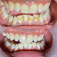 Family Dental Care (drg.Helni RY dan drg.Tito R)