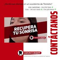 All-on-4, Zygomatic & Strategic Full Arch Implants | Veneers | Facial Feminization Surgery FFS | Dental Tourism by OdontoSOAT
