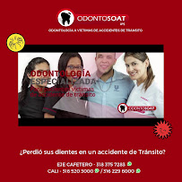 All-on-4, Zygomatic & Strategic Full Arch Implants | Veneers | Facial Feminization Surgery FFS | Dental Tourism by OdontoSOAT