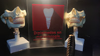 All-on-4, Zygomatic & Strategic Full Arch Implants | Veneers | Facial Feminization Surgery FFS | Dental Tourism by OdontoSOAT