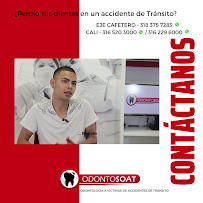 All-on-4, Zygomatic & Strategic Full Arch Implants | Veneers | Facial Feminization Surgery FFS | Dental Tourism by OdontoSOAT