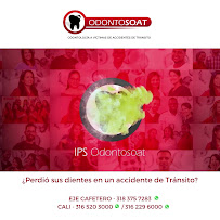 All-on-4, Zygomatic & Strategic Full Arch Implants | Veneers | Facial Feminization Surgery FFS | Dental Tourism by OdontoSOAT